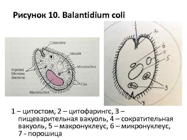 Балантидий кишечный строение
