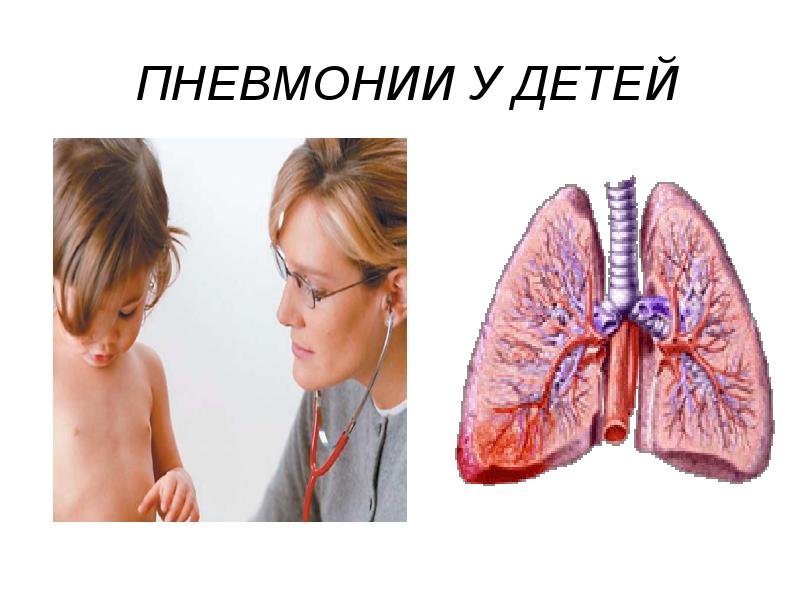 Внебольничная пневмония у детей