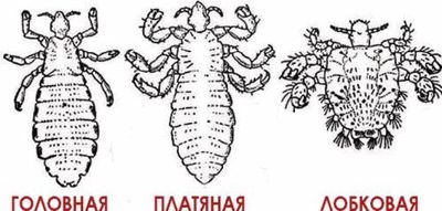 Платяная вошь рисунок с обозначениями