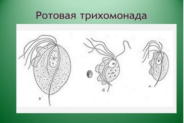 Урогенитальная трихомонада