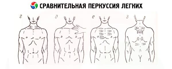 Сравнительная и топографическая перкуссия грудной клетки