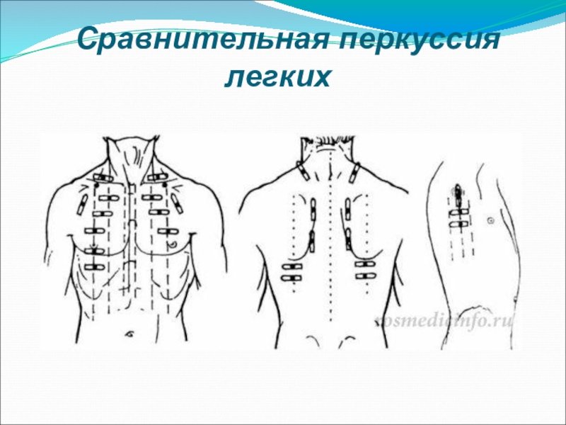 Топографическая перкуссия грудной клетки пропедевтика