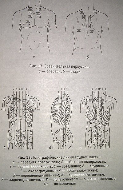 Топографическая перкуссия грудной клетки пропедевтика