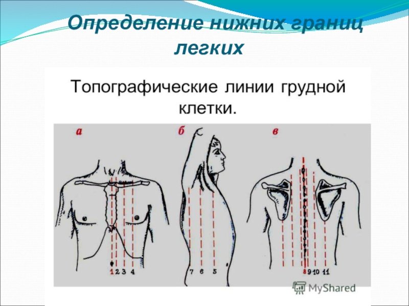 Клиническая топография грудной клетки пропедевтика