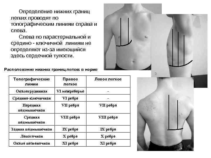 Топографическая перкуссия лёгких нижние границы