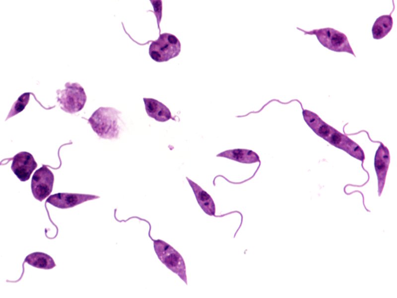Leishmania Tropica возбудитель