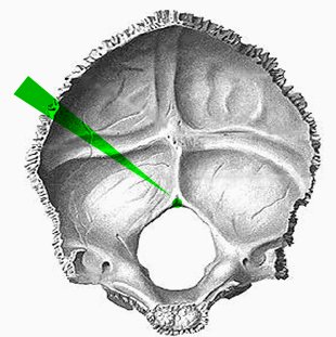 Затылочная кость sulcus Sinus sigmoidei