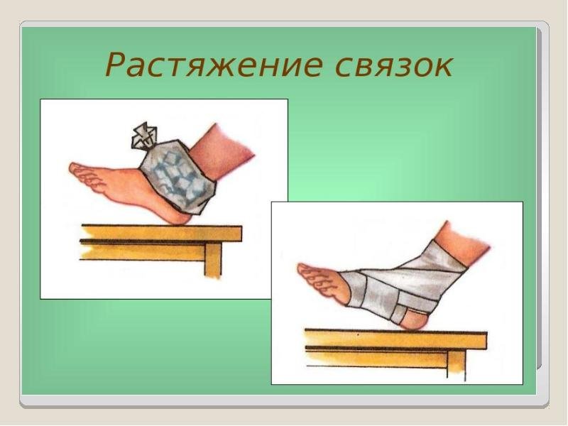 Рисунок на тему растяжение