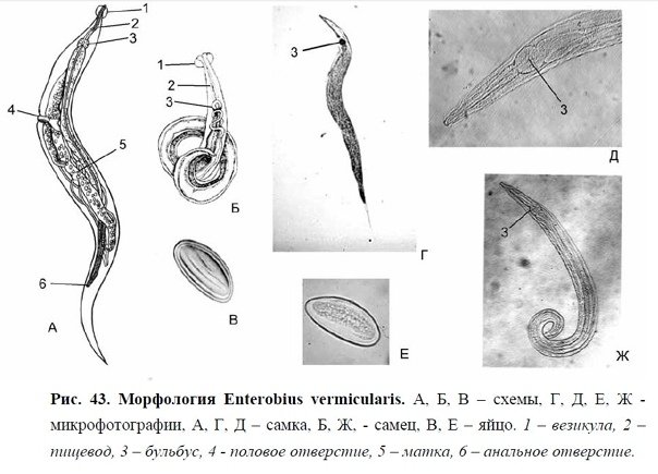 Острица детская Enterobius vermicularis