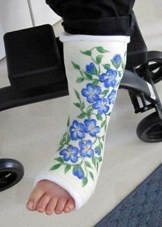 Украшенный гипс