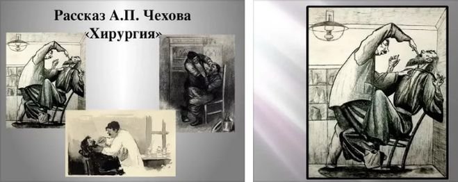 Чехов хирургия иллюстрации к рассказу