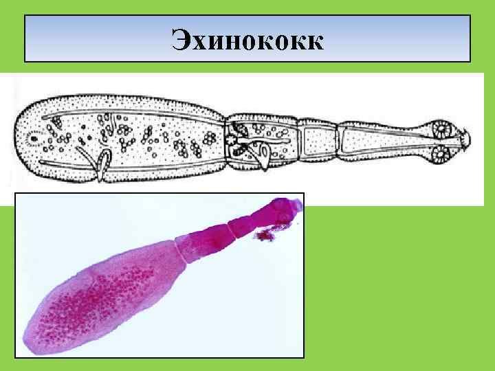 Ленточный червь эхинококк
