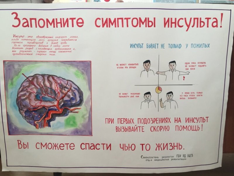 Санбюллетень профилактика инсульта