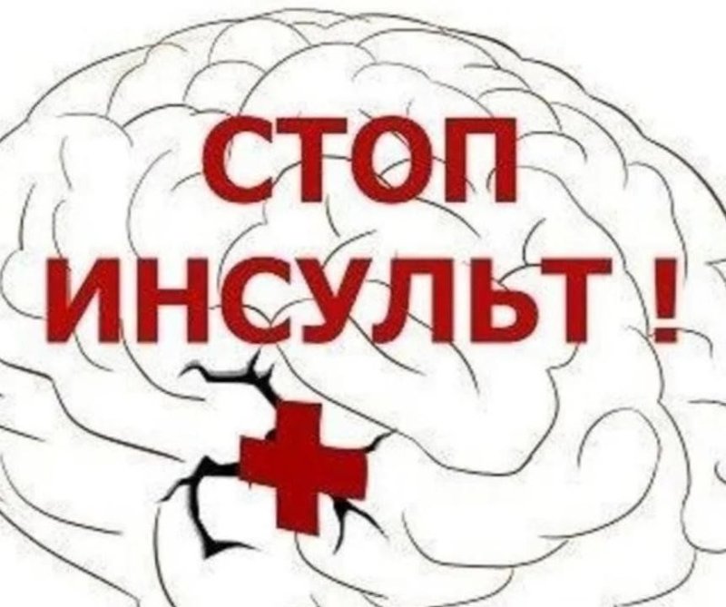 Стоп инсульт