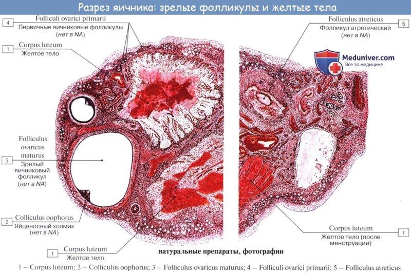 Строение яичника в разрезе