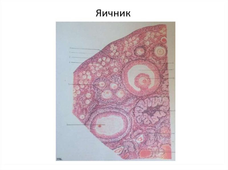 Срез яичника гистология препарат
