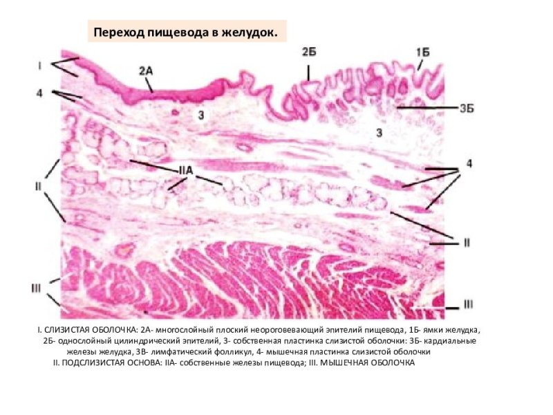 Пищеводно-желудочный переход гистология препарат