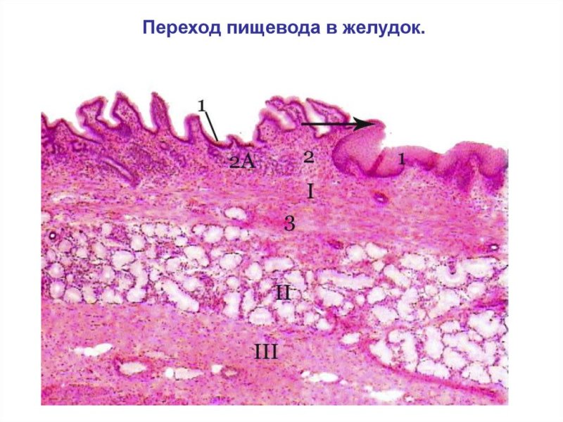 Переход пищевода в желудок препарат гистология