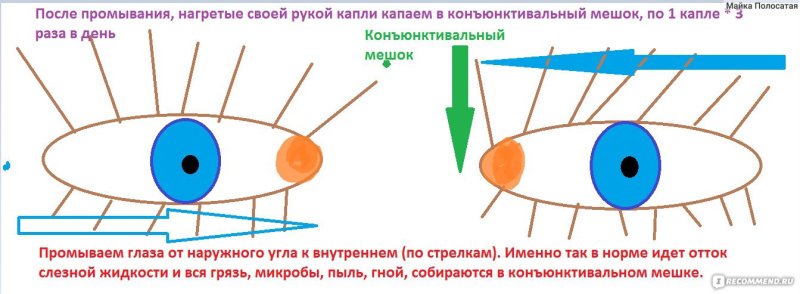 Капать капли в конъюнктивальный мешок