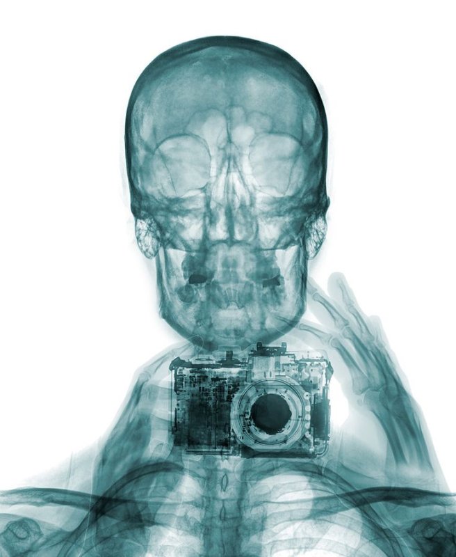 Рентген фотографа