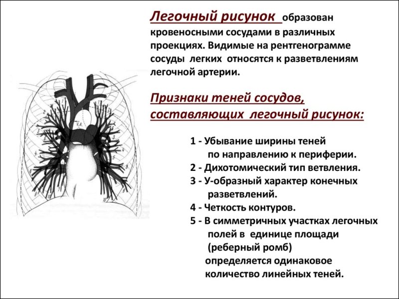 Лёгочный рисунок в норме образован