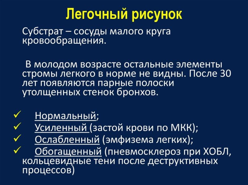 Легочный рисунок