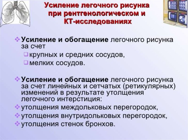 Обогащение легочного рисунка на рентгене