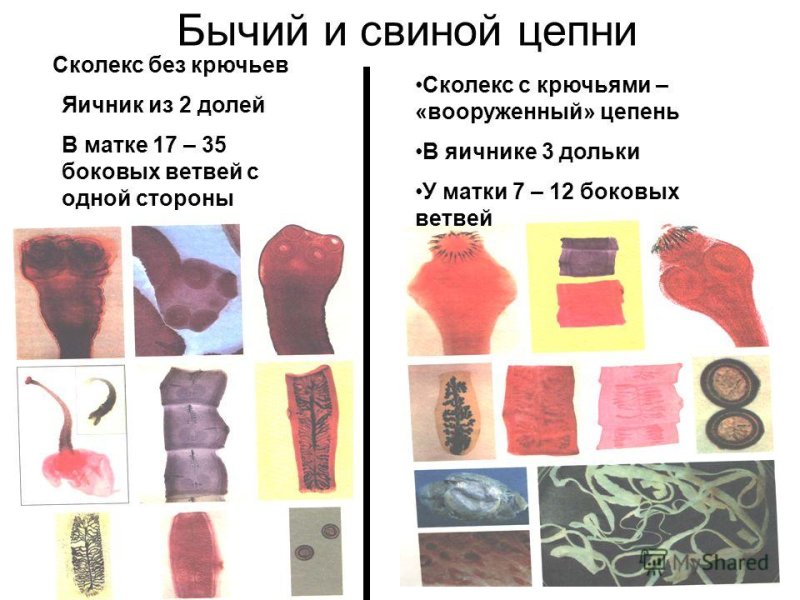 Отличие бычьего цепня от свиного