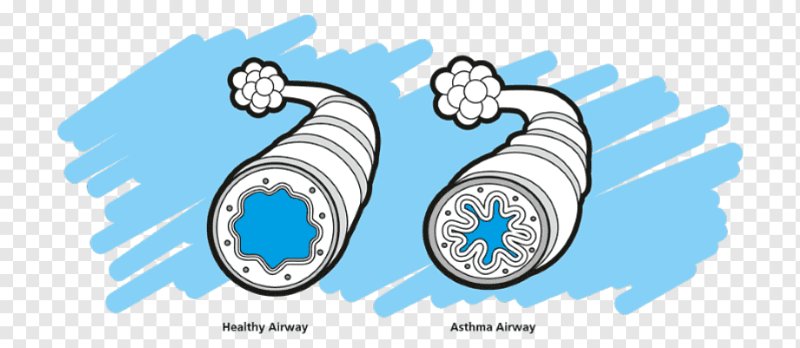 Символ бронхиальной астмы
