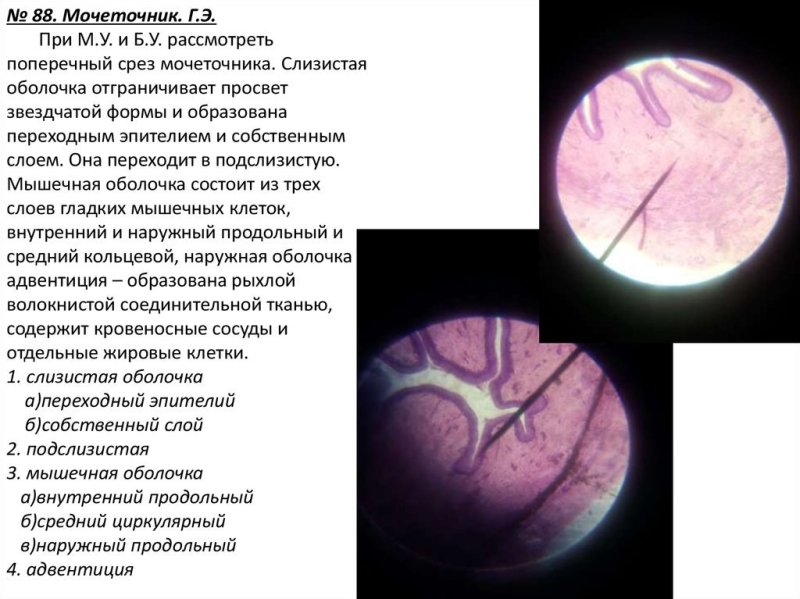 Поперечный срез мочеточника гистология