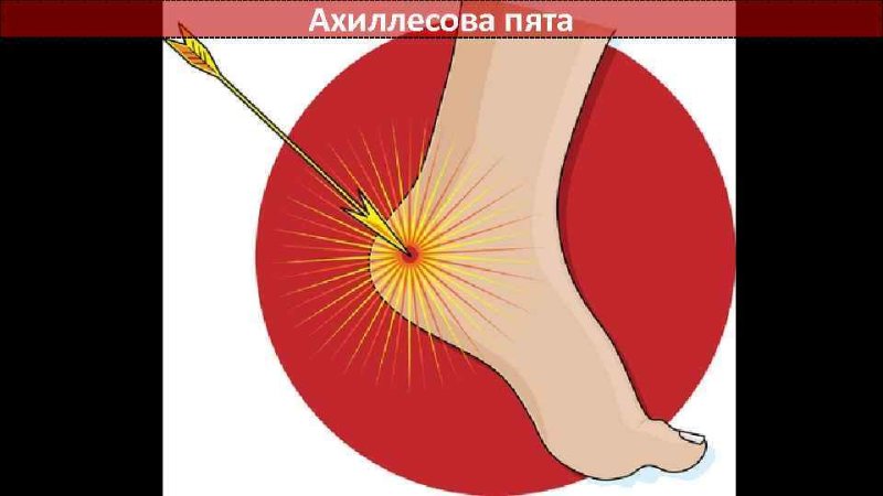 Ахиллесова пята фразеологизм