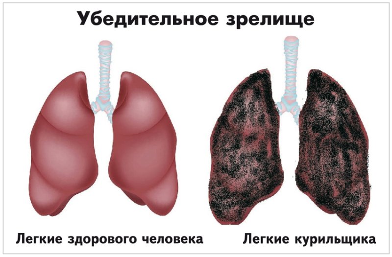 Здоровые легкие и легкие курильщика
