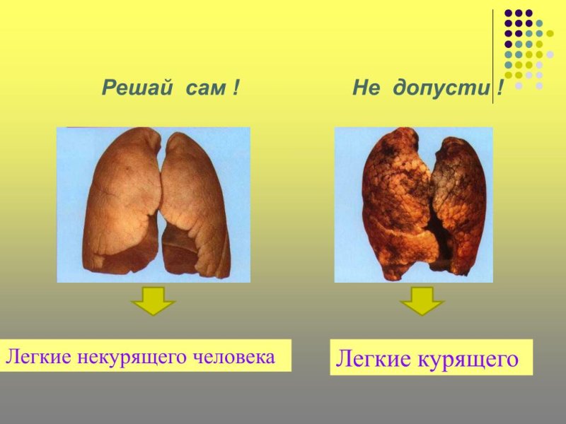 Лёгкие парющего человека