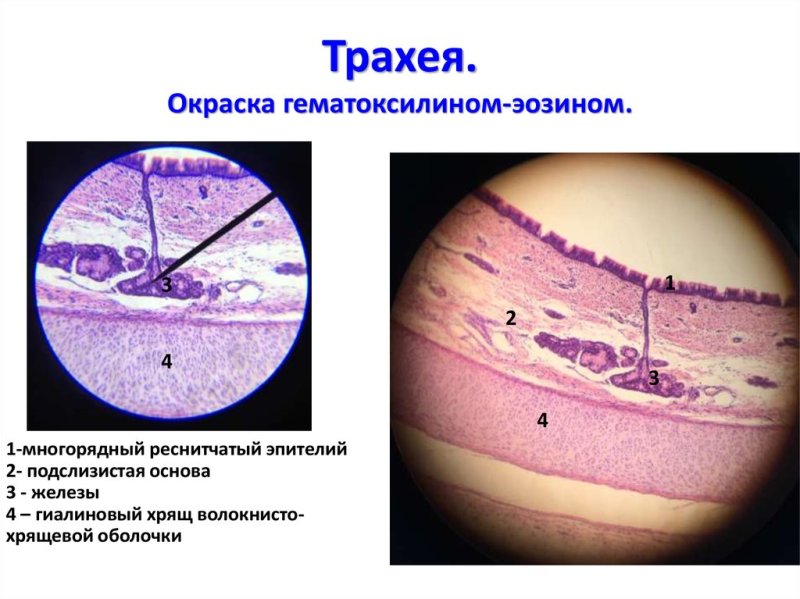Срез трахеи гистология препарат