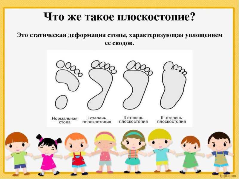 Профилактика плоскостопия у детей дошкольного возраста упражнения