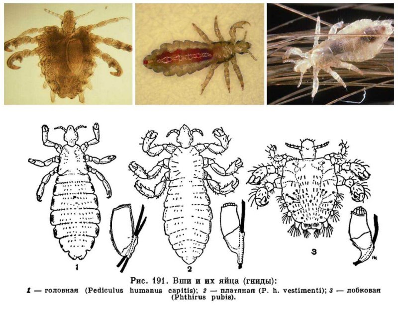 Вошь платяная (Pediculus humanus humanus