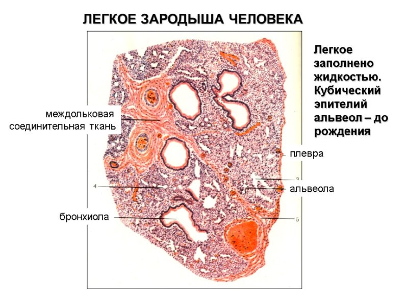Легкое недышавшего гистология препарат