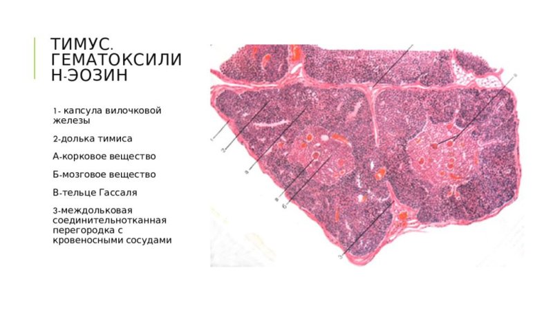 Тимус гистология препарат с подписями