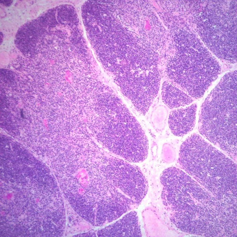 Тимус гистология препарат