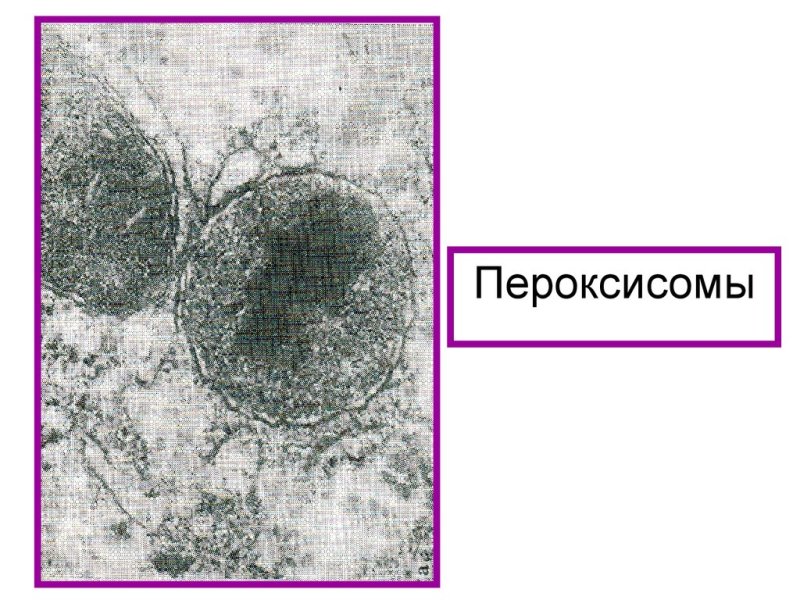 Пероксисома электронная микрофотография