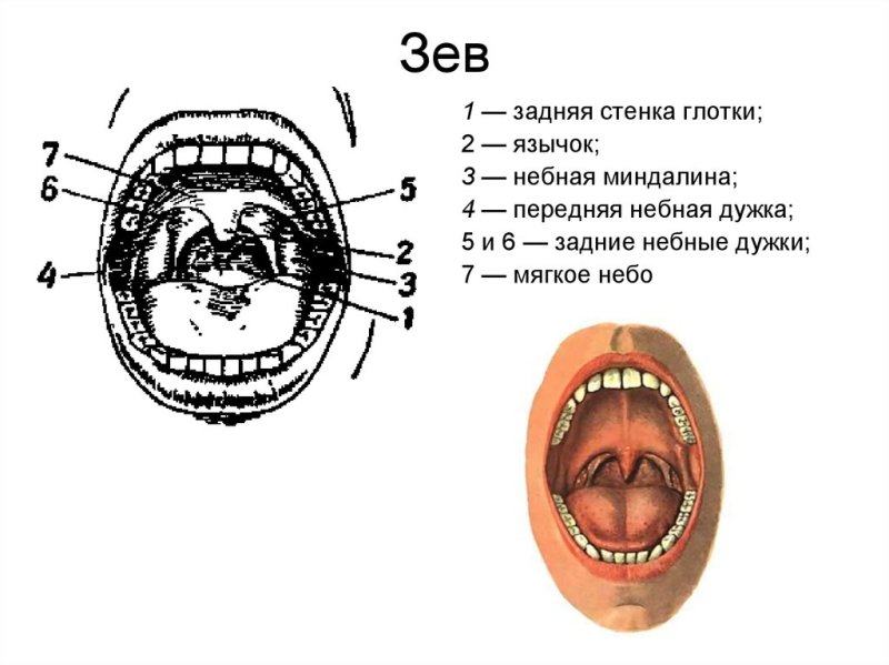 Мягкое небо небные дужки