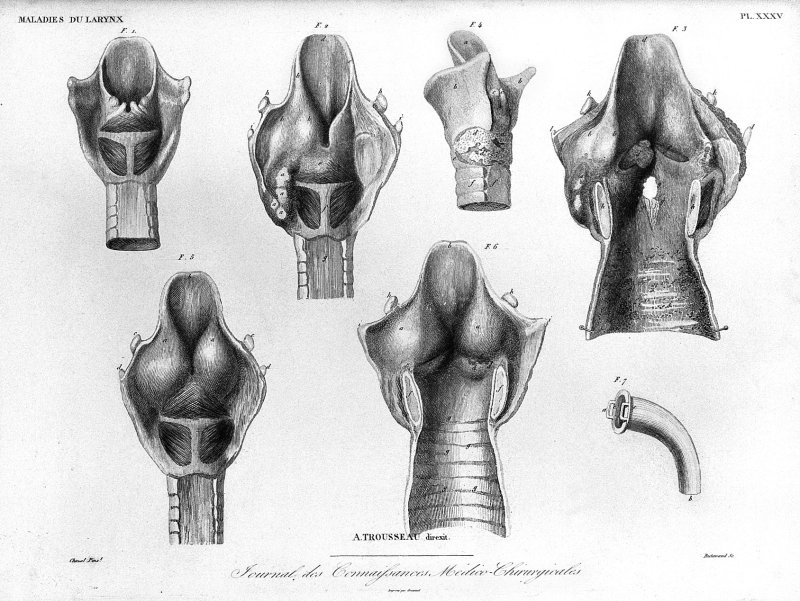 Гортань графический рисунок