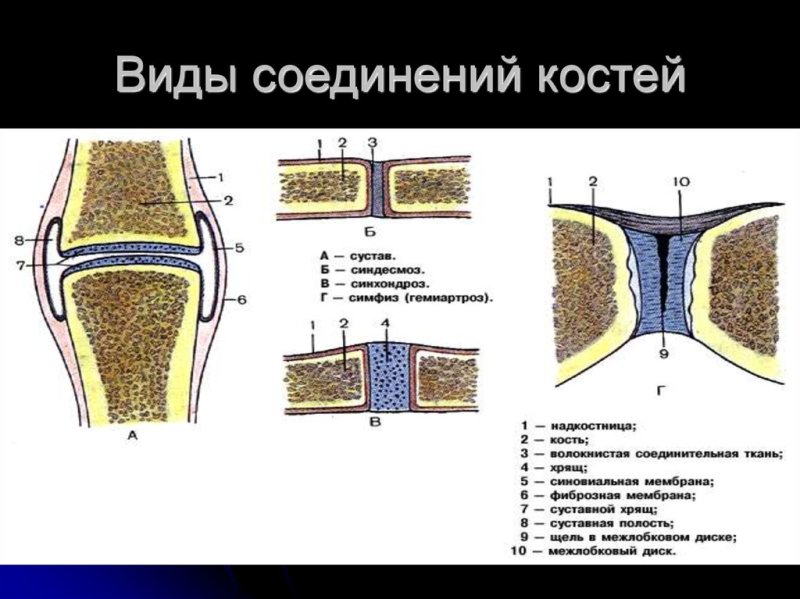 Соединение костей шов сустав