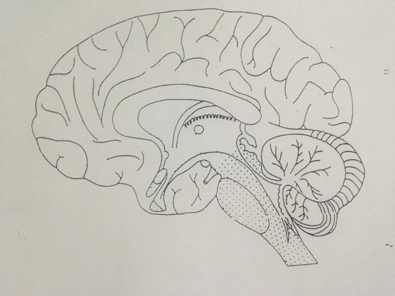 sulcus hypothalamicus