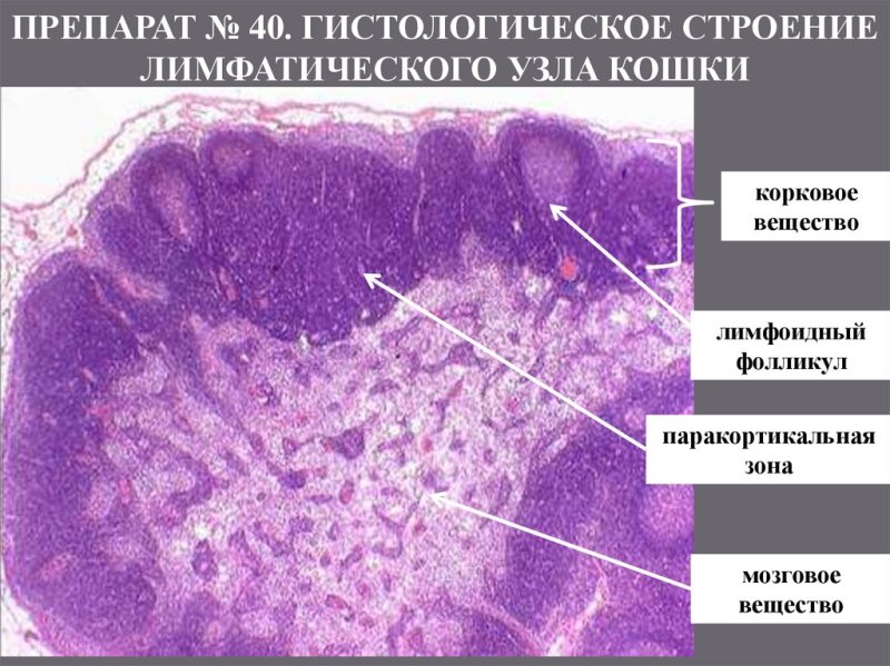 Лимфатический узел гистология