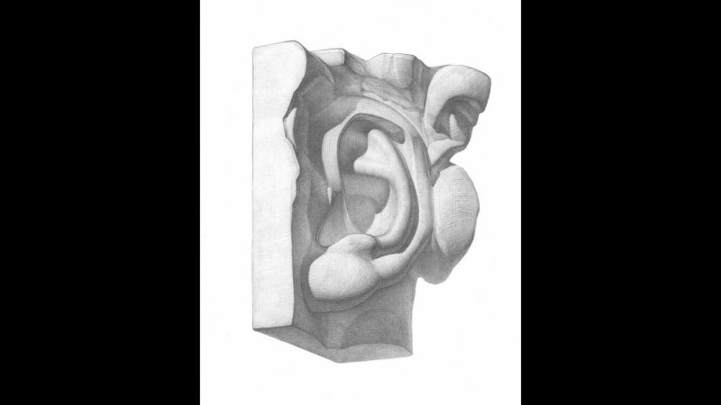 Ухо Давида гипс