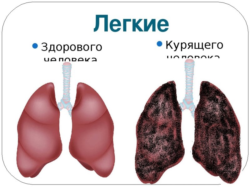 Здоровые легкие и легкие курильщика