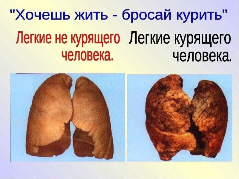 Легкие здорового и курящего человека