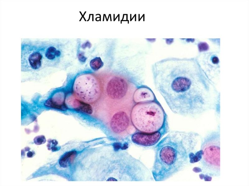 Микробиология хламидии трахоматис