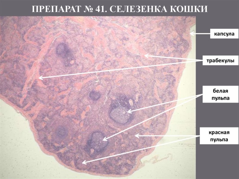 Селезенка гистология препарат